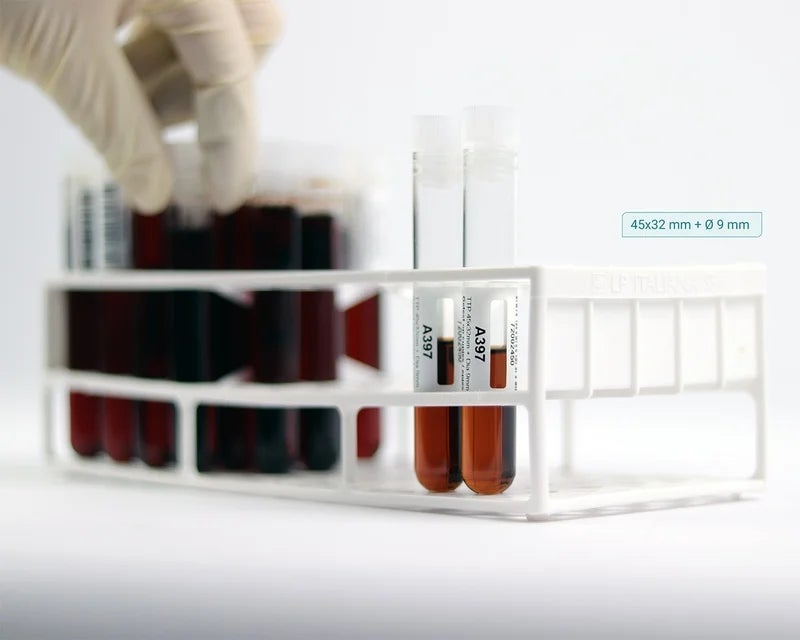 Laboratoriumrek met bloedbuisjes voorzien van witte cryogene labels met tekst