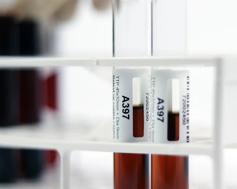 Close-up van twee transparante bloedbuisjes met witte cryogene labels